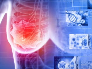 Dormant No More: Understanding Cancer Cell Dormancy and Late Recurrence in Breast Cancer