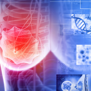 Dormant No More: Understanding Cancer Cell Dormancy and Late Recurrence in Breast Cancer