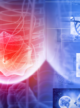 Dormant No More: Understanding Cancer Cell Dormancy and Late Recurrence in Breast Cancer