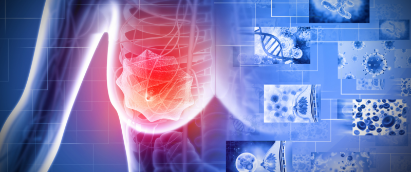 Dormant No More: Understanding Cancer Cell Dormancy and Late Recurrence in Breast Cancer